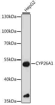 CYP26A1 Rabbit Polyclonal Antibody