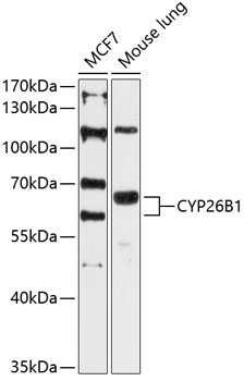 CYP26B1 Rabbit Polyclonal Antibody