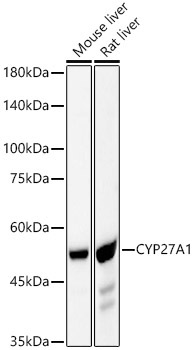 CYP27A1 Rabbit Monoclonal Antibody