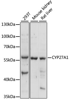CYP27A1 Rabbit Polyclonal Antibody