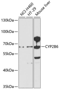 CYP2B6 Rabbit Polyclonal Antibody