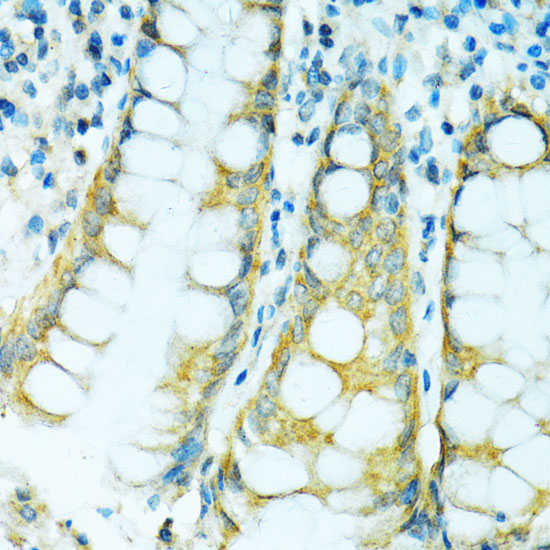CYP2B6 Rabbit Polyclonal Antibody - Image 2