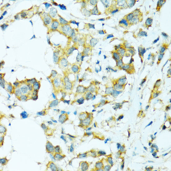 CYP2B6 Rabbit Polyclonal Antibody - Image 3