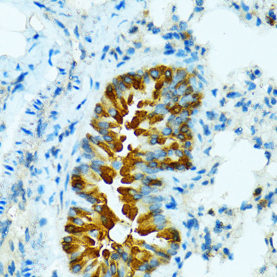 CYP2B6 Rabbit Polyclonal Antibody - Image 4