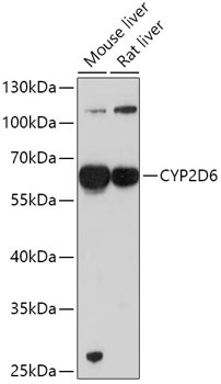 CYP2D6 Rabbit Polyclonal Antibody