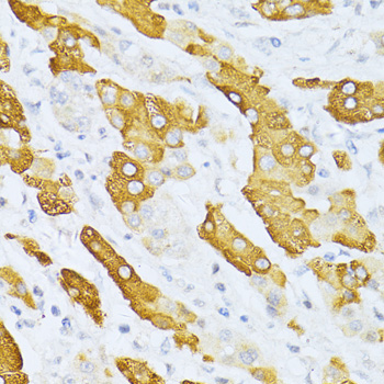 CYP2E1 Rabbit Polyclonal Antibody - Image 2