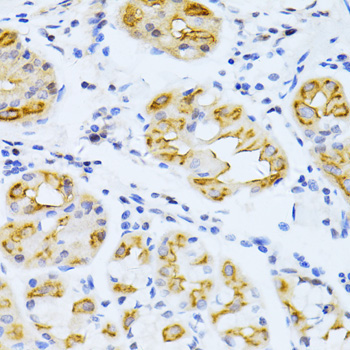 CYP2E1 Rabbit Polyclonal Antibody - Image 3