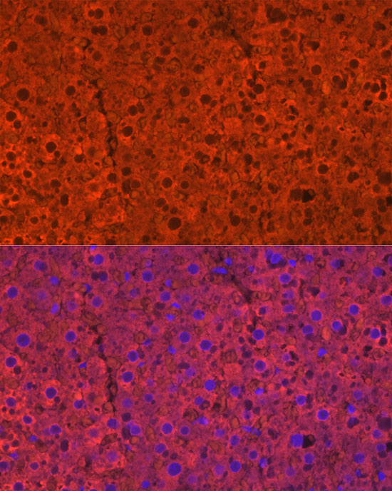 CYP2E1 Rabbit Polyclonal Antibody - Image 5