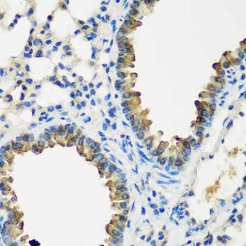CYP2F1 Rabbit Polyclonal Antibody - Image 2