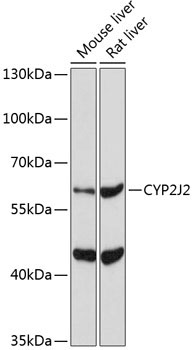 CYP2J2 Rabbit Polyclonal Antibody