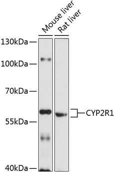 CYP2R1 Rabbit Polyclonal Antibody
