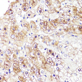 CYP3A4 Rabbit Polyclonal Antibody - Image 2