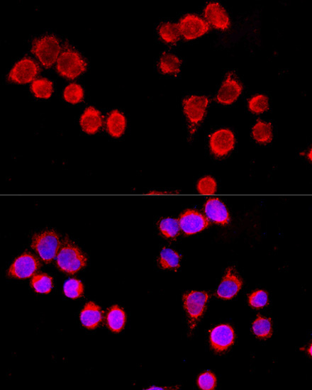 CYP3A4 Rabbit Polyclonal Antibody - Image 3