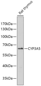 CYP3A5 Rabbit Polyclonal Antibody