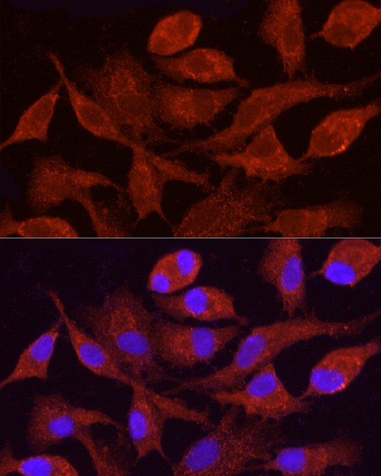 CYP4F11 Rabbit Polyclonal Antibody