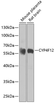 CYP4F12 Rabbit Polyclonal Antibody