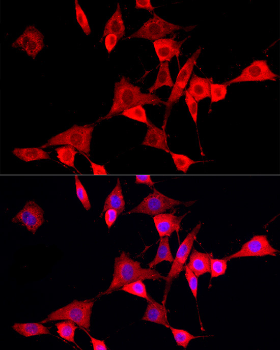 CYP4V2 Rabbit Polyclonal Antibody - Image 2