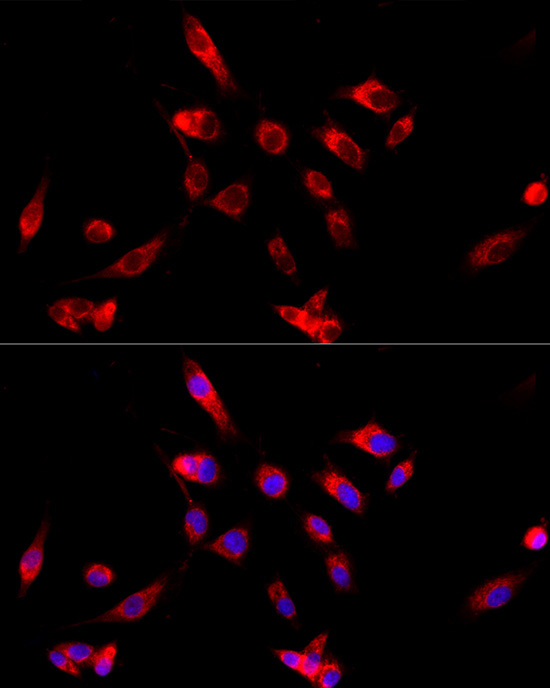 CYP4V2 Rabbit Polyclonal Antibody - Image 3
