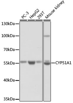 CYP51A1 Rabbit Polyclonal Antibody
