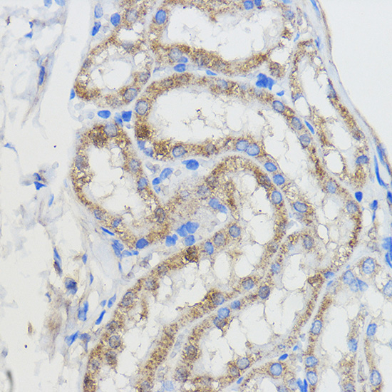 CYP51A1 Rabbit Polyclonal Antibody - Image 2