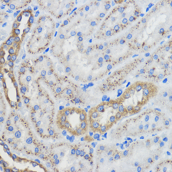 CYP51A1 Rabbit Polyclonal Antibody - Image 3