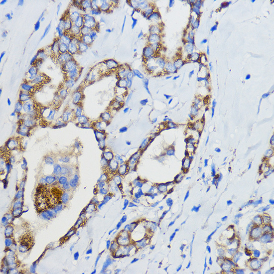 CYP51A1 Rabbit Polyclonal Antibody - Image 4