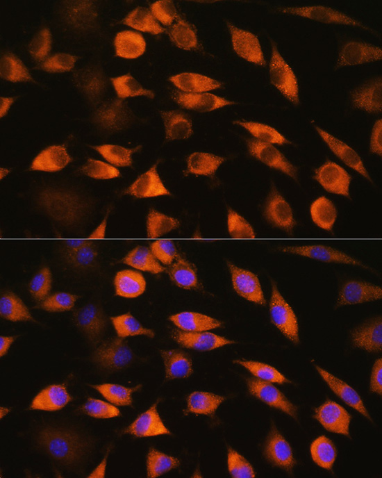 CYP51A1 Rabbit Polyclonal Antibody - Image 5