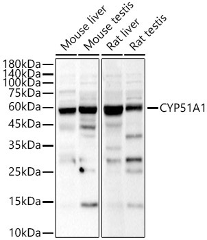 CYP51A1 Rabbit Polyclonal Antibody
