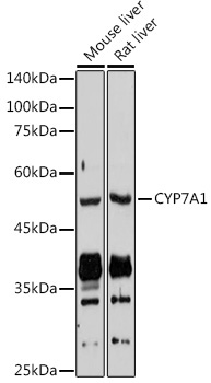 CYP7A1 Rabbit Polyclonal Antibody