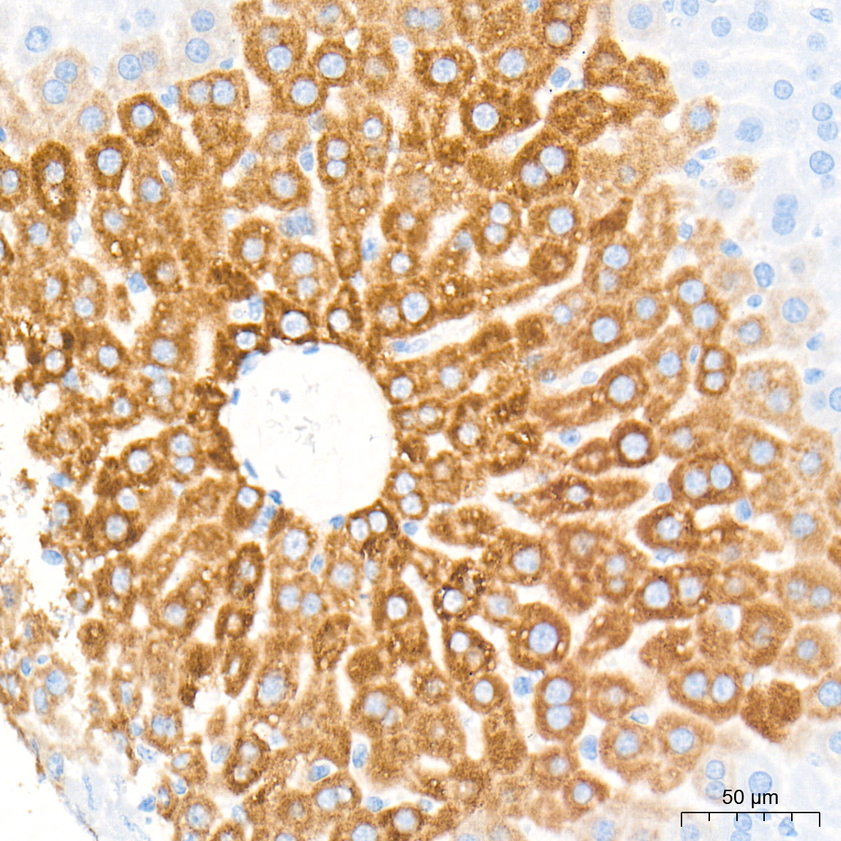 CYP7A1 Rabbit Polyclonal Antibody - Image 2