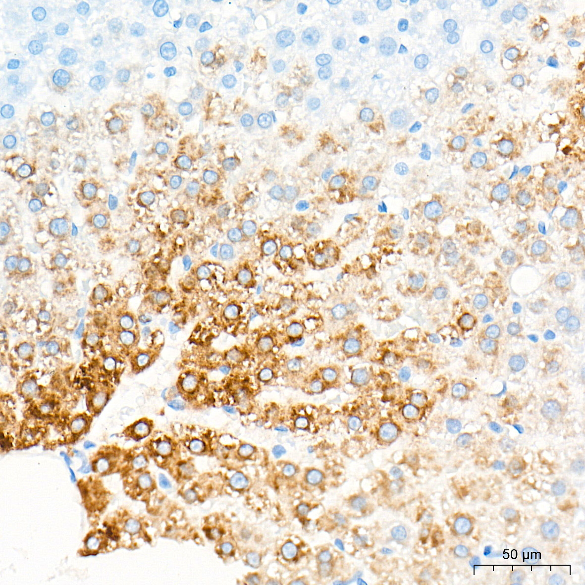 CYP7A1 Rabbit Polyclonal Antibody - Image 3