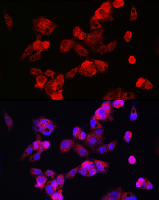 CYP7A1 Rabbit Polyclonal Antibody - Image 4