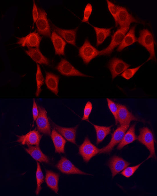 CYP7B1 Rabbit Polyclonal Antibody - Image 2