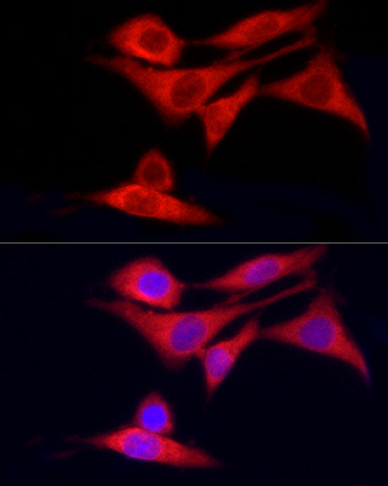 CYP7B1 Rabbit Polyclonal Antibody - Image 3