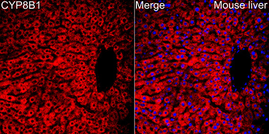 CYP8B1 Rabbit Polyclonal Antibody - Image 2