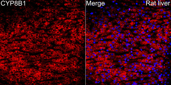 CYP8B1 Rabbit Polyclonal Antibody - Image 3