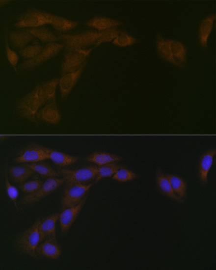 CYPOR Rabbit Monoclonal Antibody - Image 7