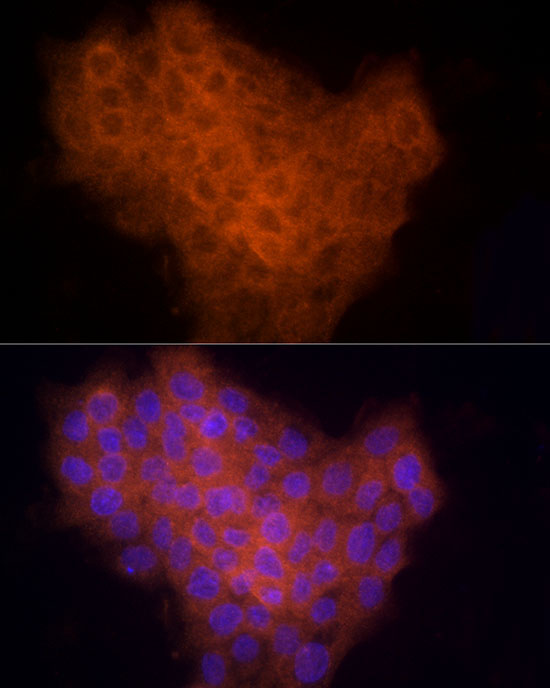 CYR61 Rabbit Polyclonal Antibody - Image 2