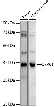 CYR61 Rabbit Polyclonal Antibody