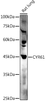 CYR61 Rabbit Polyclonal Antibody - Image 2