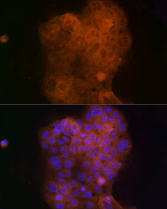 CYR61 Rabbit Polyclonal Antibody - Image 3