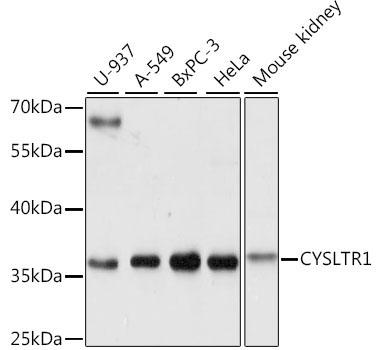 CYSLTR1 Rabbit Polyclonal Antibody