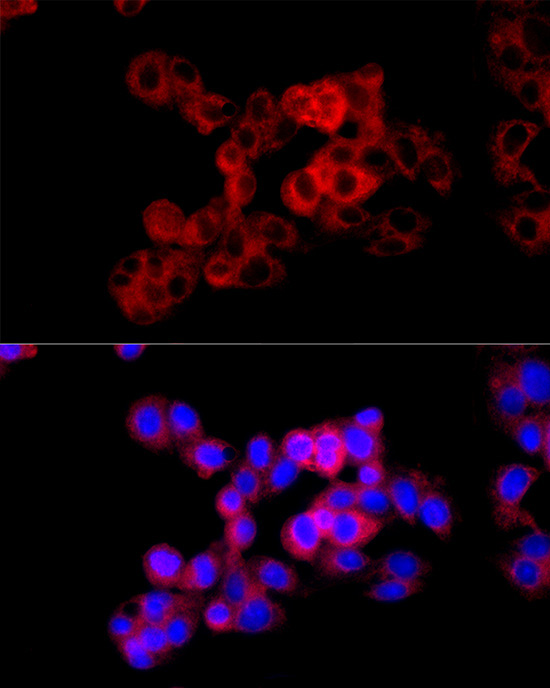 Cystathionase/CTH Rabbit Polyclonal Antibody - Image 2