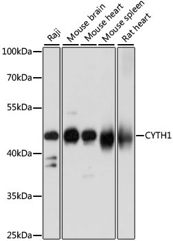 CYTH1 Rabbit Polyclonal Antibody