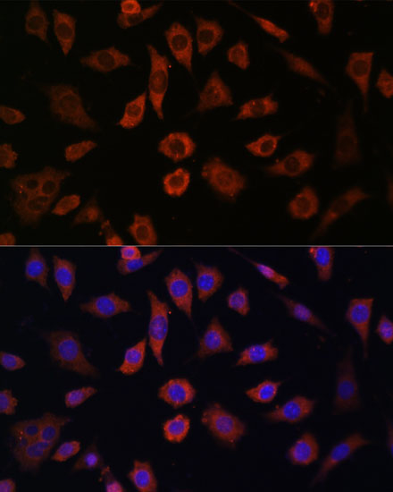 CYTH1 Rabbit Polyclonal Antibody - Image 2