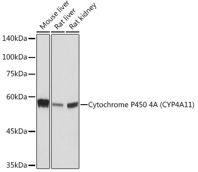 Cytochrome P450 4A (CYP4A11) Rabbit Monoclonal Antibody