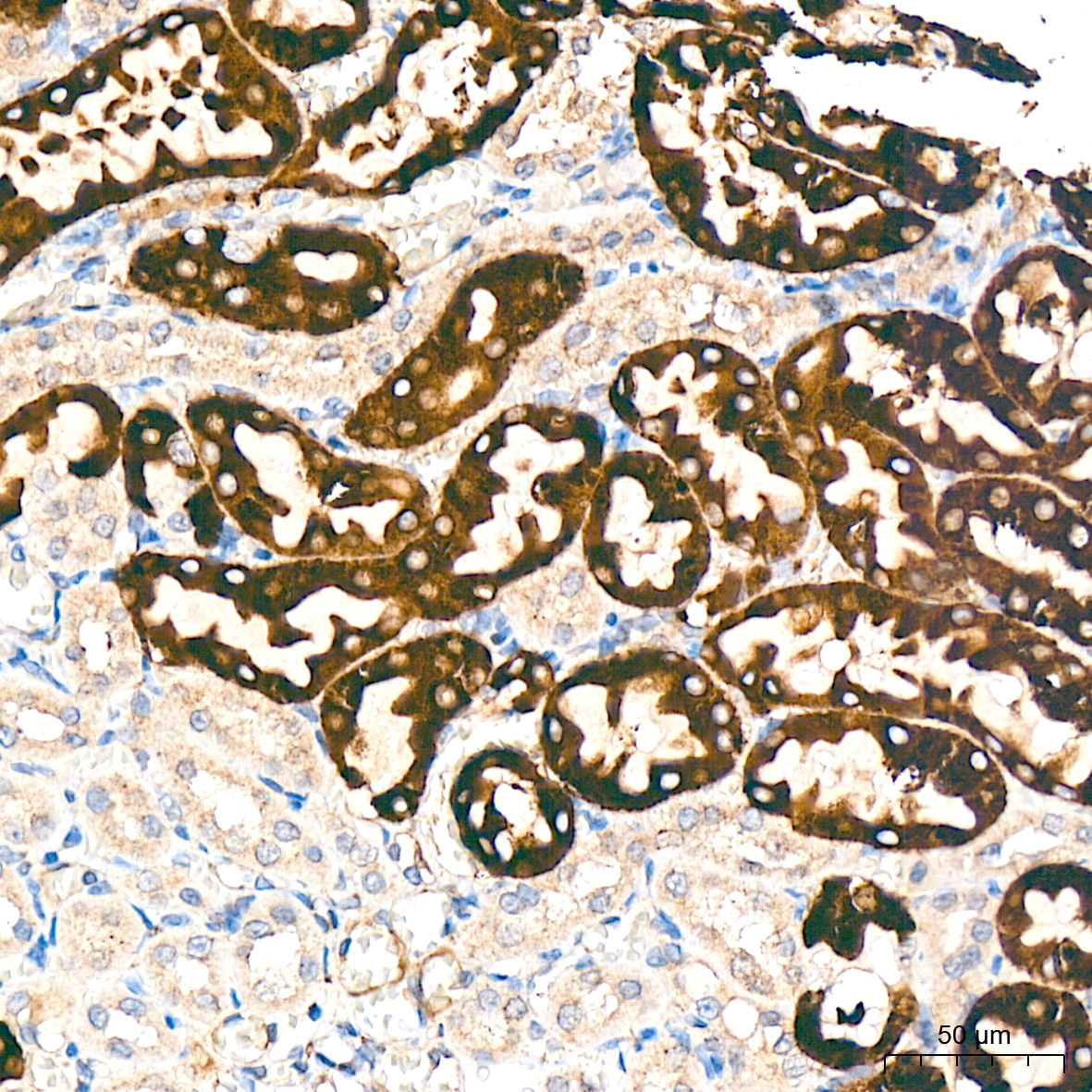 Cytochrome P450 4A (CYP4A11) Rabbit Monoclonal Antibody - Image 2