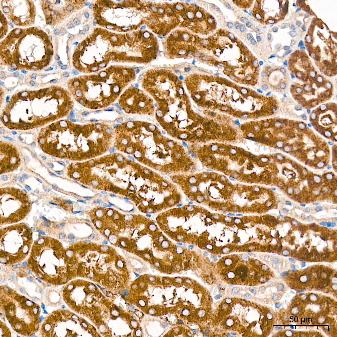 Cytochrome P450 4A (CYP4A11) Rabbit Monoclonal Antibody - Image 3