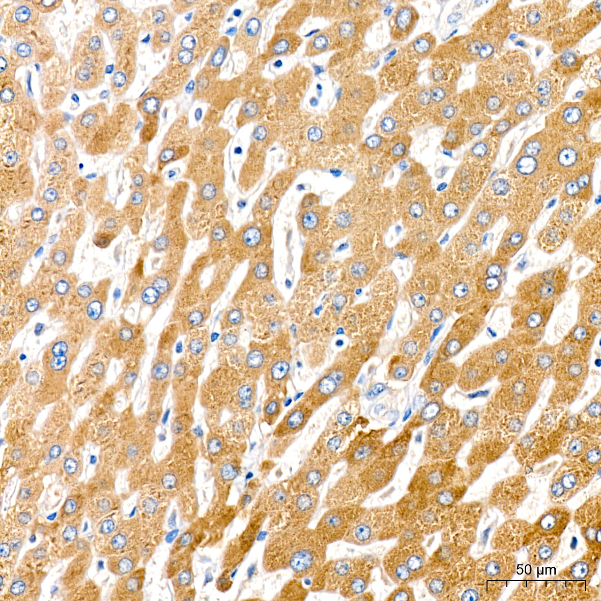 Cytochrome P450 4A (CYP4A11) Rabbit Monoclonal Antibody - Image 4