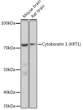 Cytokeratin 1 (KRT1) Rabbit Monoclonal Antibody